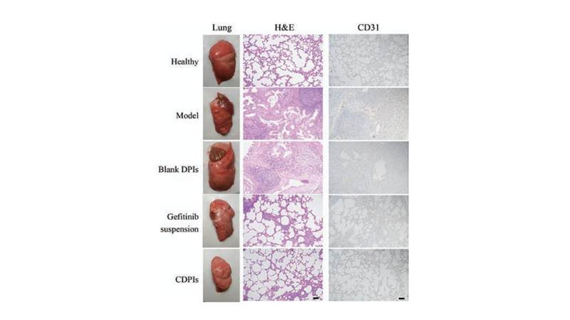 Dry powder inhalers of conjugated linoleic acid for the treatment of primary lung cancer